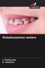 Distalizzazione molare