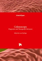 Colonoscopy - Diagnostic and Therapeutic Advances
