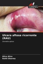 Ulcera aftosa ricorrente (RAU)