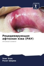 Recidiwiruüschaq aftoznaq qzwa (RAU)