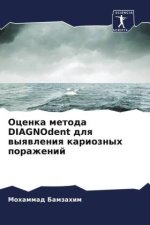 Ocenka metoda DIAGNOdent dlq wyqwleniq karioznyh porazhenij