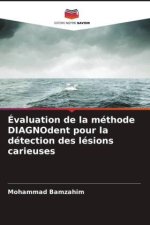 Évaluation de la méthode DIAGNOdent pour la détection des lésions carieuses