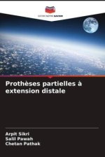 Prothèses partielles à extension distale