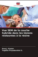 Vue SEM de la couche hybride dans les lésions restaurées ? la résine