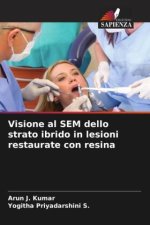 Visione al SEM dello strato ibrido in lesioni restaurate con resina