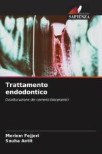 Trattamento endodontico