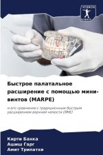 Bystroe palatal'noe rasshirenie s pomosch'ü mini-wintow (MARPE)
