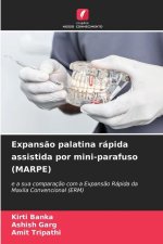 Expansão palatina rápida assistida por mini-parafuso (MARPE)