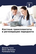 Kostnye transplantaty w regeneracii parodonta