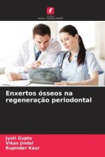 Enxertos ósseos na regeneraç?o periodontal