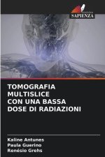 TOMOGRAFIA MULTISLICE CON UNA BASSA DOSE DI RADIAZIONI