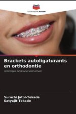 Brackets autoligaturants en orthodontie