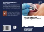 Metody udaleniq kariesa w raznye äpohi