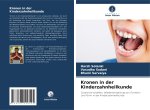 Kronen in der Kinderzahnheilkunde