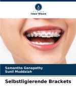 Selbstligierende Brackets