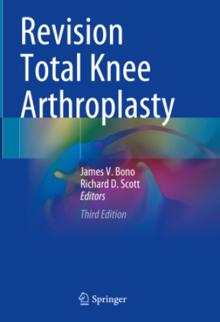 Revision Total Knee Arthroplasty (James V. Bono,Richard D. Scott)()