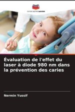 Évaluation de l'effet du laser à diode 980 nm dans la prévention des caries