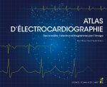 Atlas d’électrocardiographie