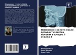 Izmeneniq skeleta posle ortodonticheskogo lecheniq w klasse II otdela 1