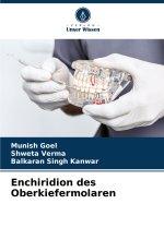 Enchiridion des Oberkiefermolaren