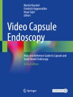 Video Capsule Endoscopy