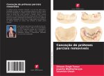 Conceção de próteses parciais removíveis