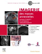 Imagerie des masses annexielles
