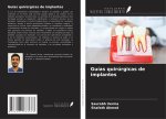 Guías quirúrgicas de implantes