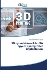 3D nyomtatással készülö egyedi nyeregízület implantátum