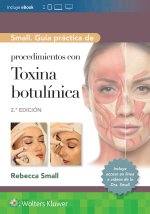 SMALL GUIA PRACTICA DE PROCEDIMIENTOS CON TOXINA BOTULINICA