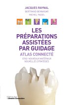 PREPARATIONS ASSISTEES PAR GUIDAGE