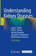 Understanding Kidney Diseases, m. 1 Buch, m. 1 E-Book