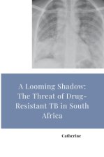 A Looming Shadow: The Threat of Drug-Resistant TB in South Africa