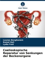 Coelioskopische Reparatur von Senkungen der Beckenorgane