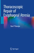 Thoracoscopic Repair of Esophageal Atresia