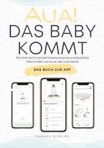 Aua! Das Baby kommt