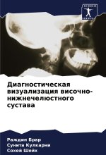Diagnosticheskaq wizualizaciq wisochno-nizhnechelüstnogo sustawa