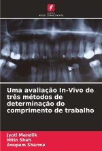 Uma avaliaç?o In-Vivo de tr?s métodos de determinaç?o do comprimento de trabalho