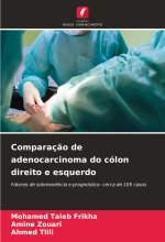 Comparaç?o de adenocarcinoma do cólon direito e esquerdo