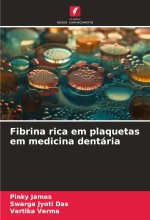 Fibrina rica em plaquetas em medicina dentária
