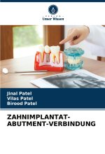 ZAHNIMPLANTAT-ABUTMENT-VERBINDUNG