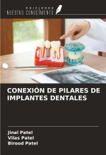 CONEXIÓN DE PILARES DE IMPLANTES DENTALES