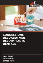 CONNESSIONE DELL'ABUTMENT DELL'IMPIANTO DENTALE