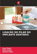 LIGAÇ?O DO PILAR DO IMPLANTE DENTÁRIO