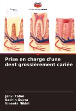 Prise en charge d'une dent grossi?rement cariée