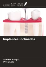 Implantes inclinados