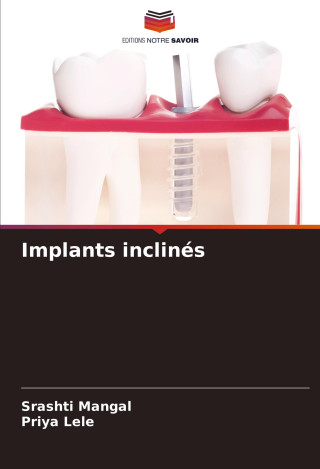 Implants inclinés