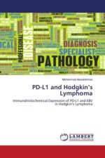 PD-L1 and Hodgkin?s Lymphoma