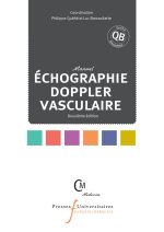 échographie doppler vasculaire