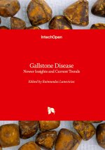 Gallstone Disease